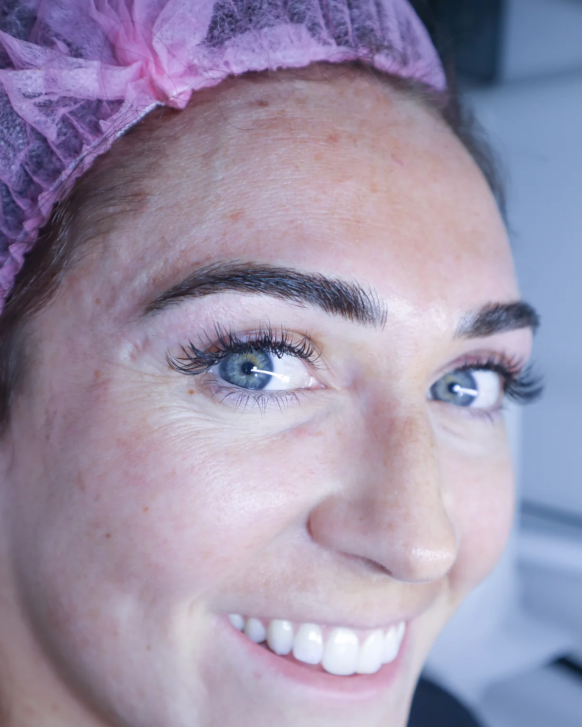 Client result 2 after microblading