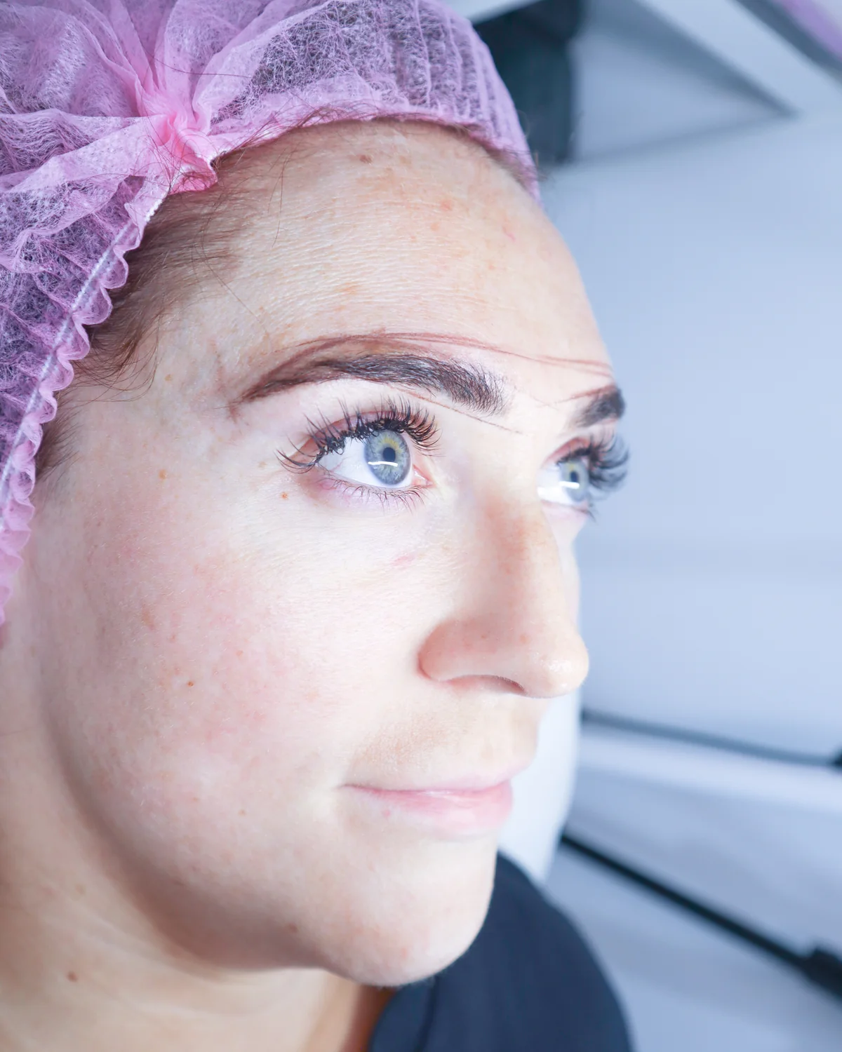 Client result 2 before microblading
