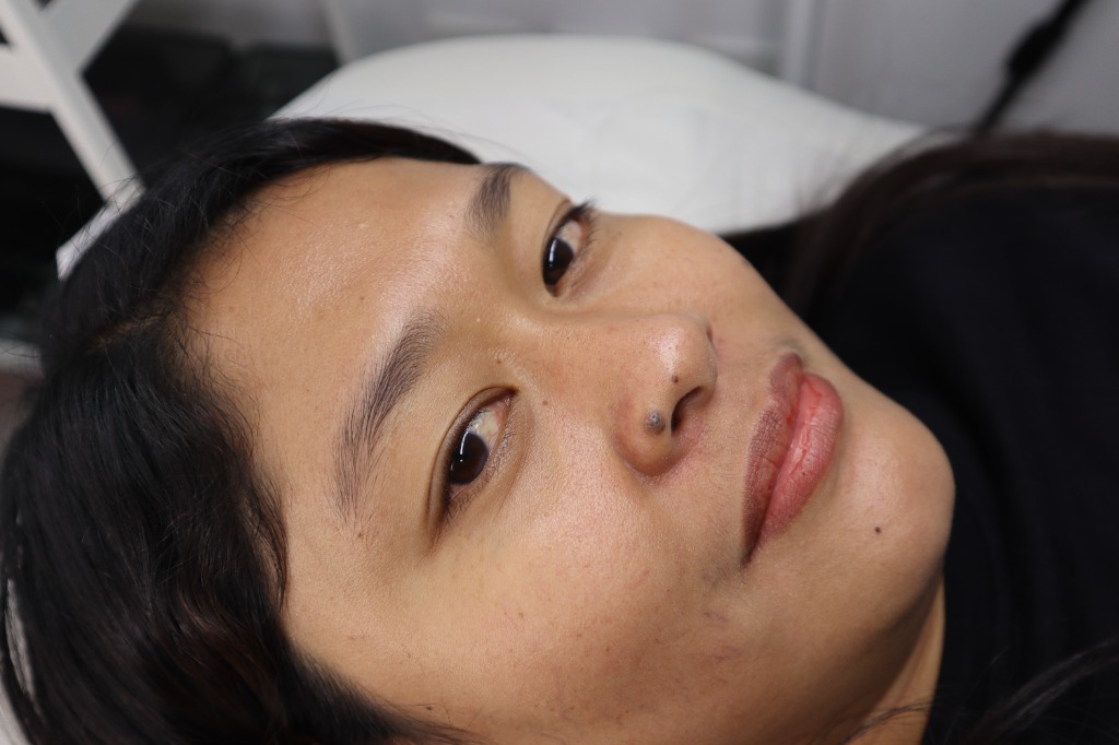 Client result 4 before microblading